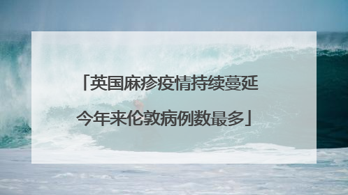 英国麻疹疫情持续蔓延 今年来伦敦病例数最多
